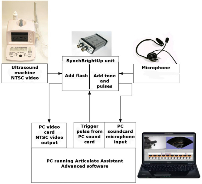 ultrasound machine diagram